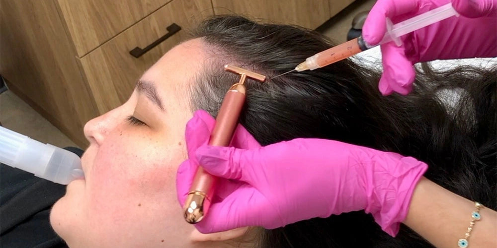 Hair restoration with prf in Houston Texas