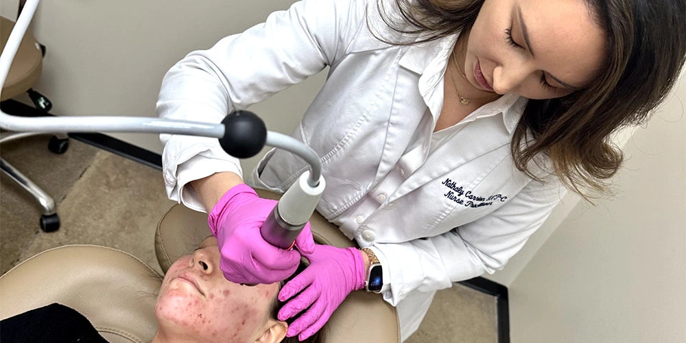 Acne scars treatment by The Skin Clinic in Houston Texas
