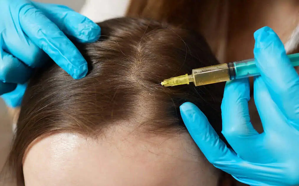 Hair Restoration