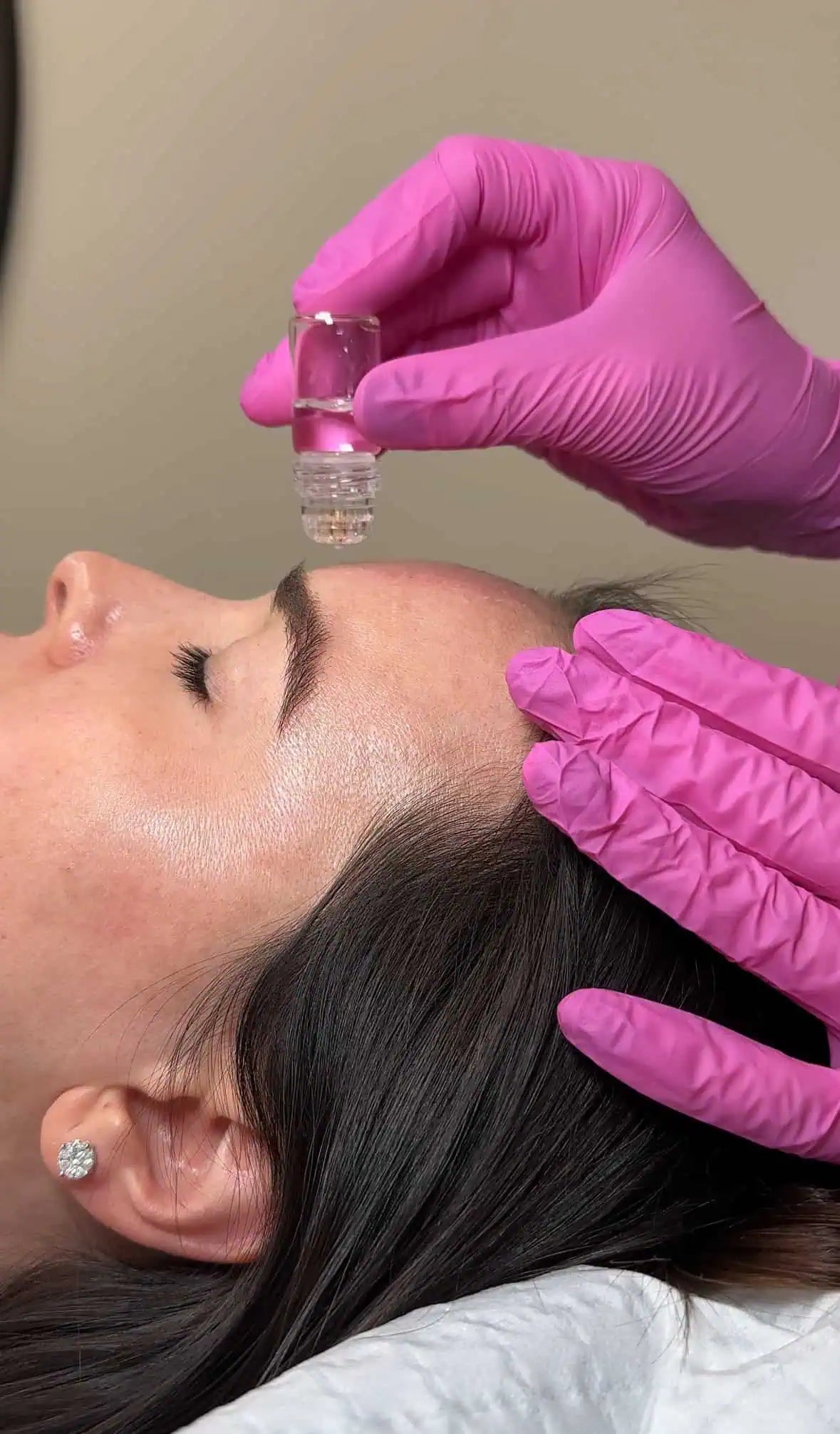 Microinfusion by The Skin Clinic in Houston, TX