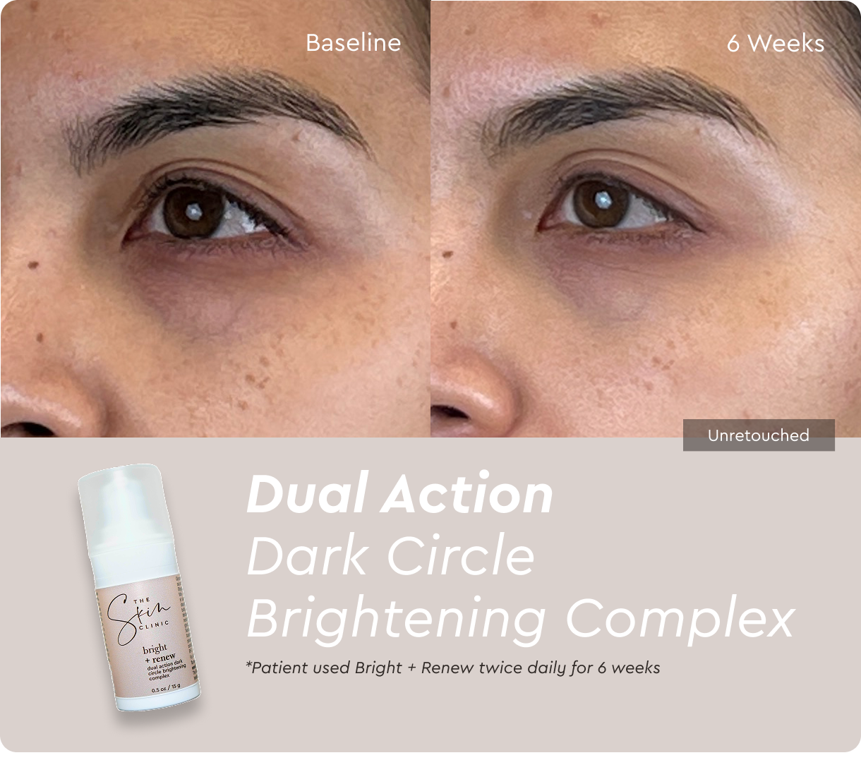 Bright + Renew Eye Cream