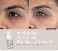 Bright + Renew Eye Cream