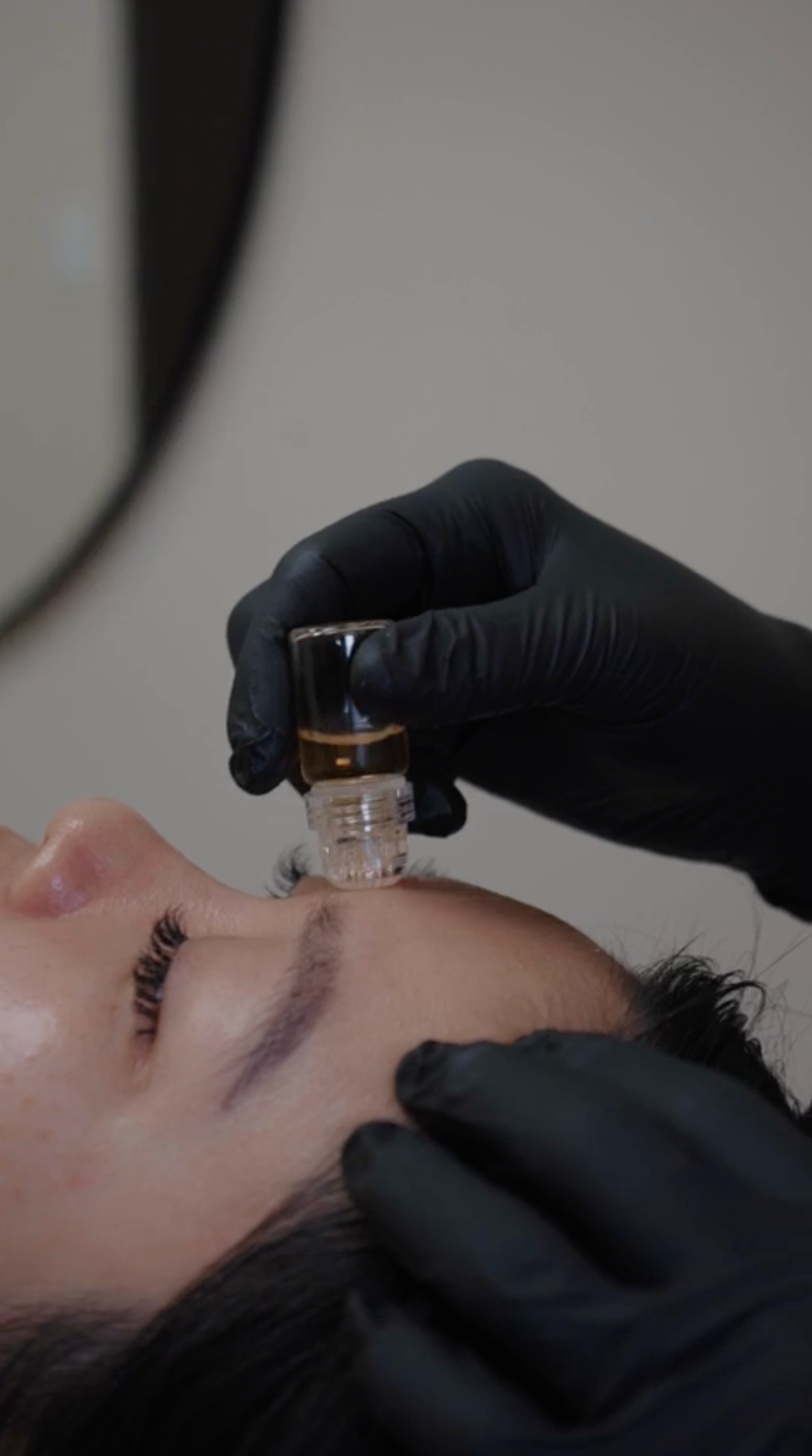 Microinfusion