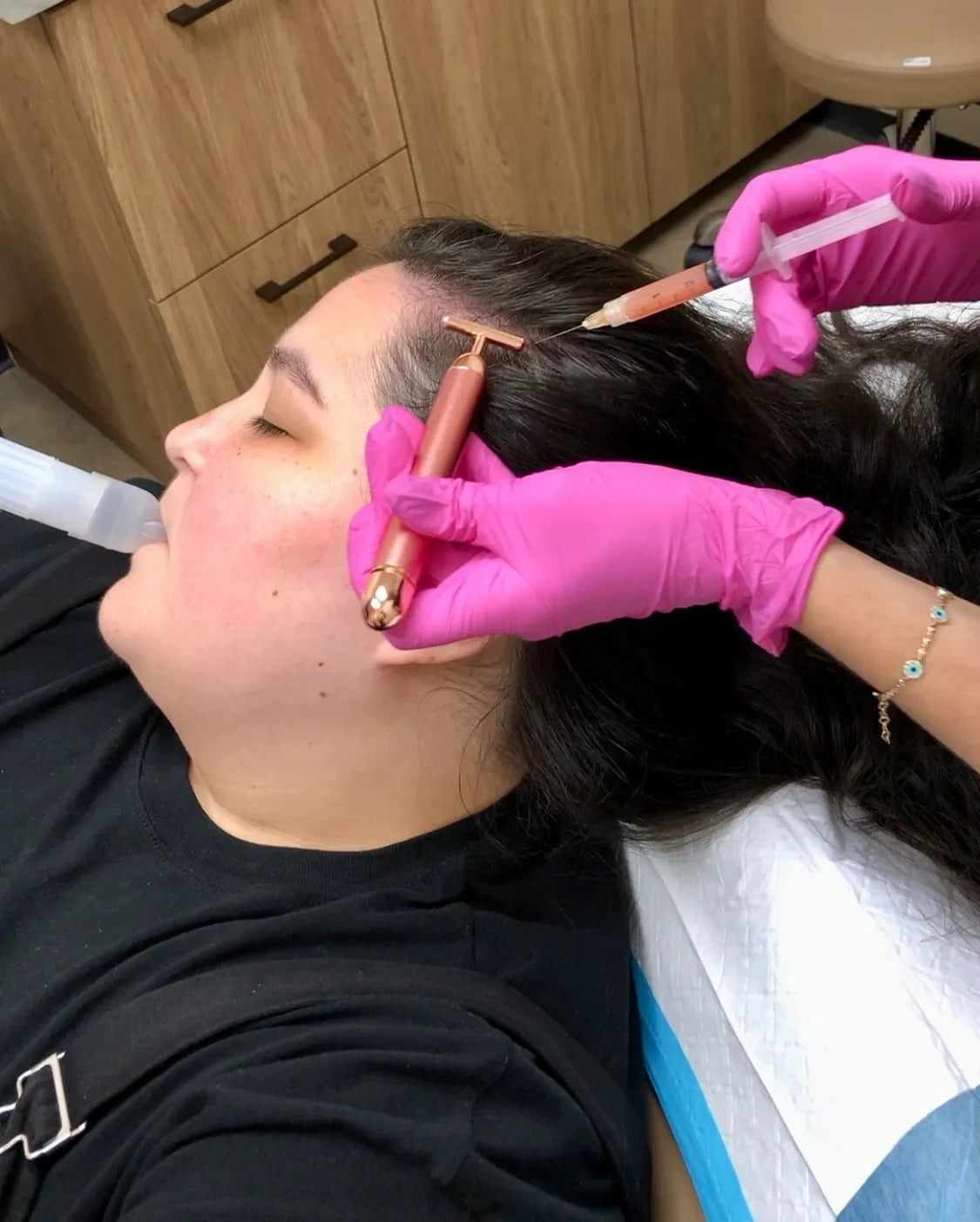 Hair Restoration With Prf