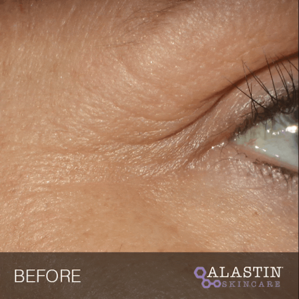 Restorative Eye Treatment