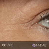 Restorative Eye Treatment