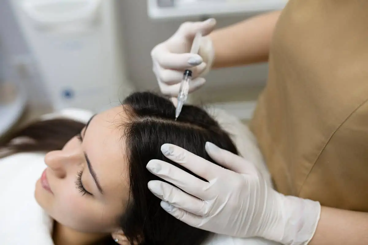 PRF for Hair Restoration by the skin clinic htx in Houston Texas