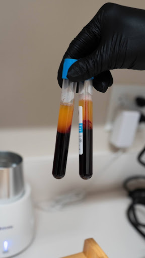 prf injections by the Skin Clinic in Houston, TX