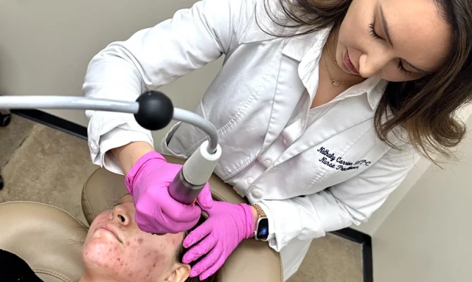 Acne scars treatment by The Skin Clinic in Houston Texas