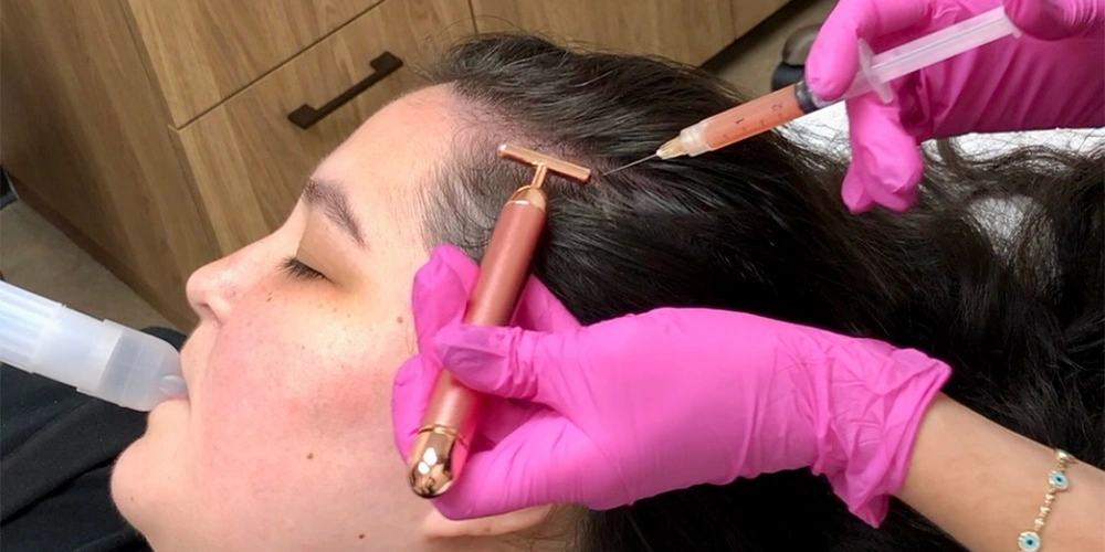 Hair restoration with prf in Houston Texas