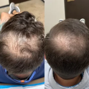 men's hair