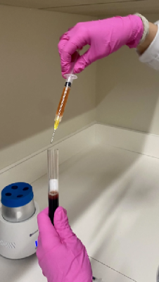 PRF Injections