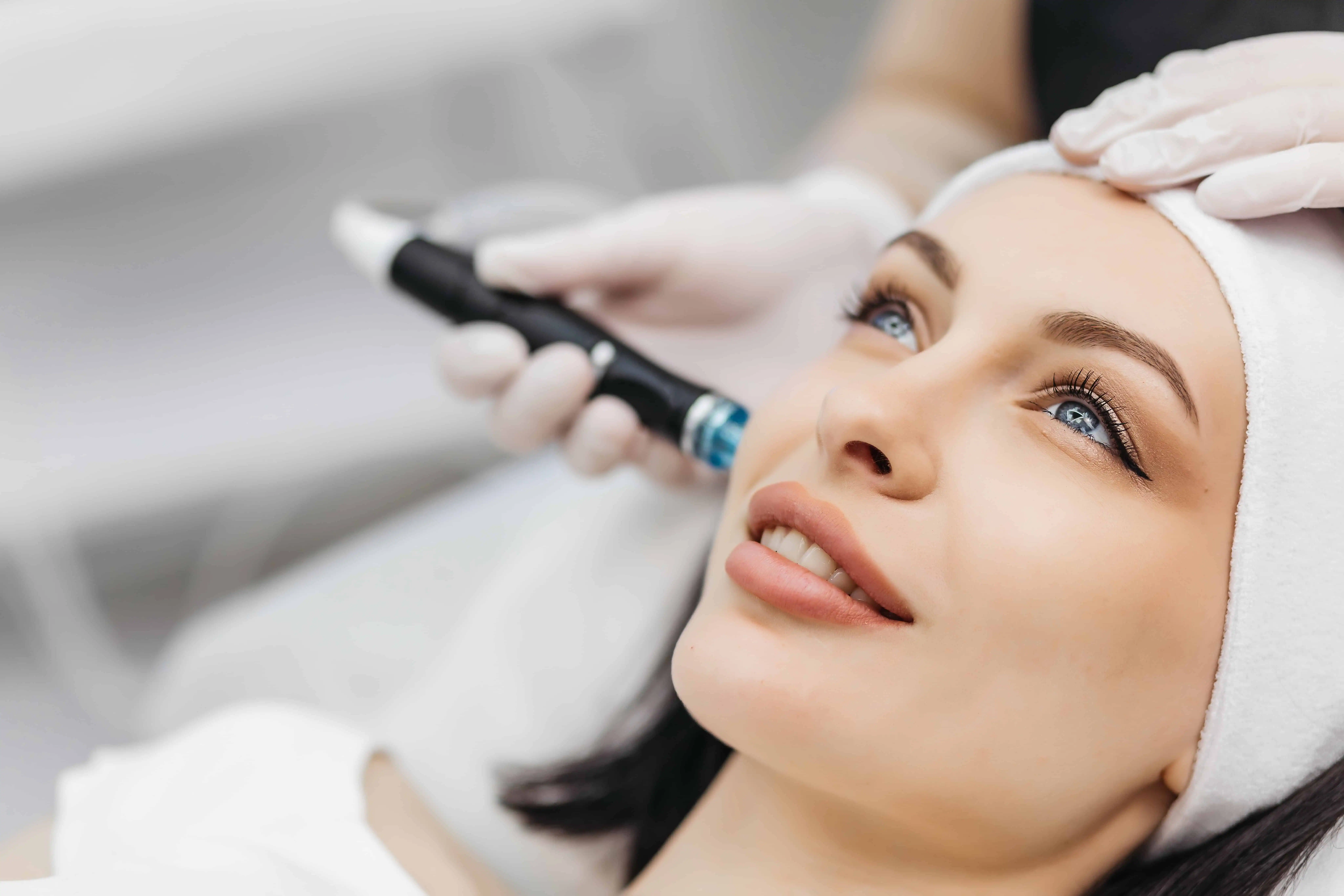 Skinpen Microneedling treatment ongoing