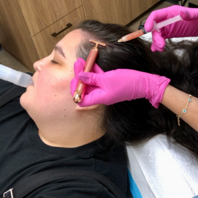 Hair Restoration by The Skin Clinic in Houston Texas