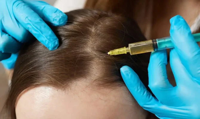 Hair Restoration